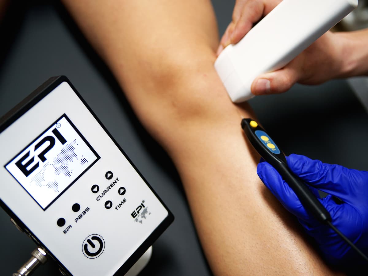 Electròlisi Percutània Intratisular Ecoguiada (EPI)